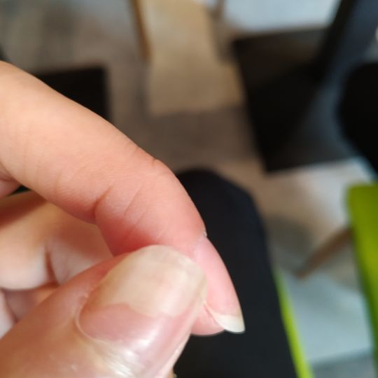 为什么里面的指甲不粘肉了