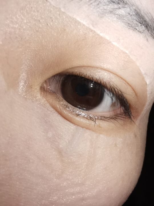 睫毛都长到内眼角了已经长到外面来了怎么办不敢刮怕越刮越多也怕不