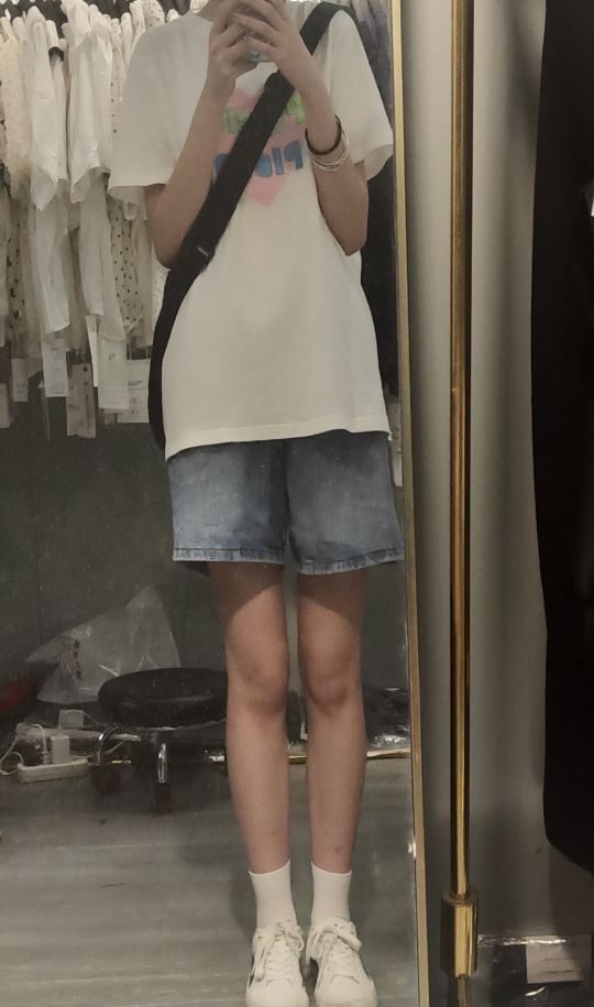 家人们这腿正常吗膝盖往中间走01